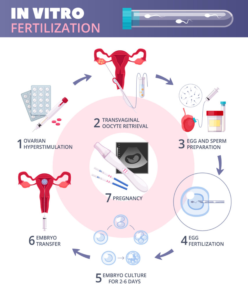 Thời gian cần thiết để thực hiện một chu kỳ IVF là bao lâu?