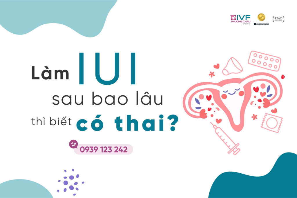 Làm IUI sau bao lâu thì biết có thai?
